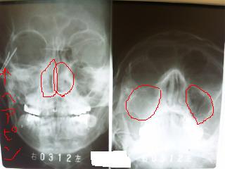 レントゲン いかい耳鼻咽喉科スタッフブログ